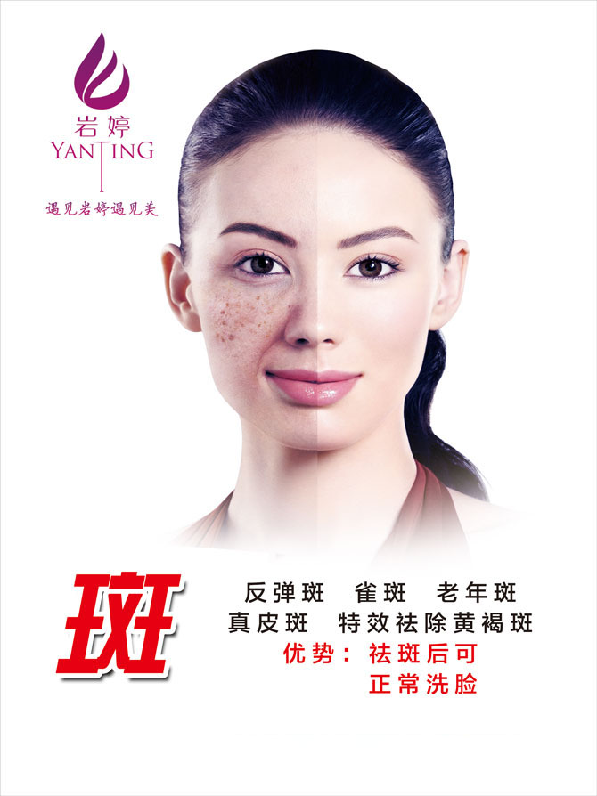 岩婷祛斑系列