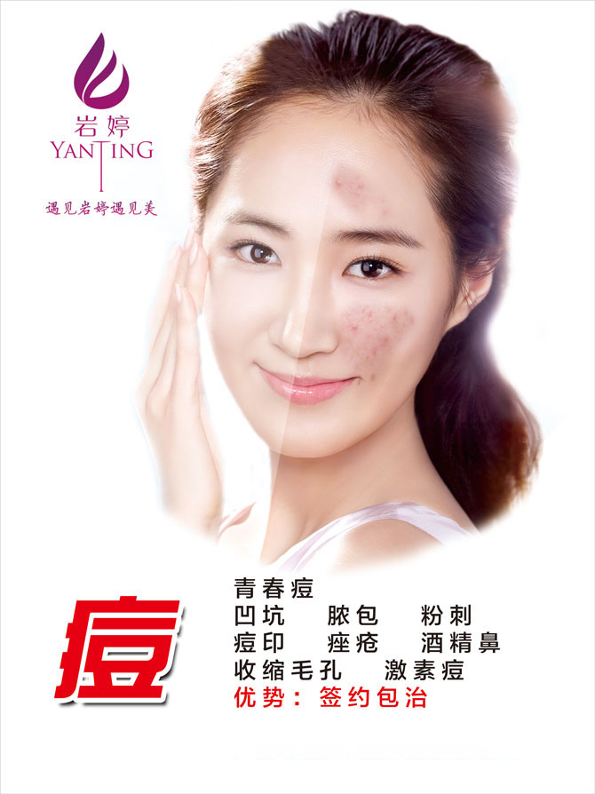 岩婷祛痘系列