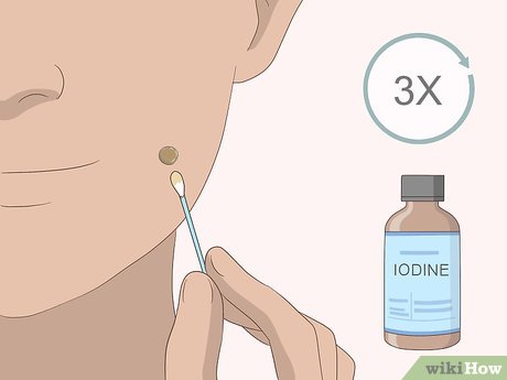 以Remove Moles Quickly Step 11为标题的图片