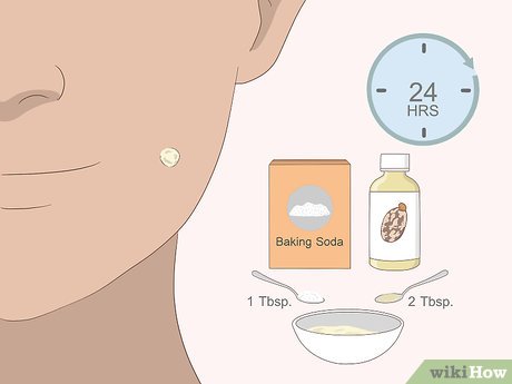 以Remove Moles Quickly Step 14为标题的图片
